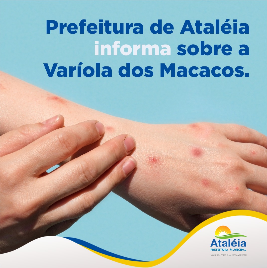 A PREFEITURA DE ATALÉIA ORIENTA SOBRE A VARÍOLA DOS ...